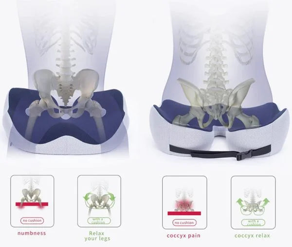 Ergonomisch zitkussen voor drukverlichting en ondersteuning van heupen, stuitje en onderrug | Restfield